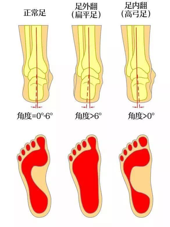 foot.jpg