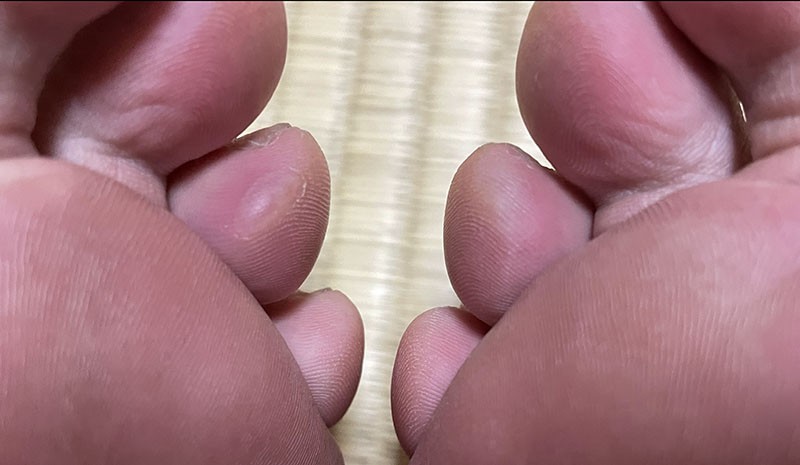 　晚上檢查一下雙腳，左尾二腳趾三個星期前練習18公里起的水泡還未脫完皮又起了一個小水泡，右尾二腳趾有些疼，看來也快起水泡了。今天由熊野本宮到旅館的那三公里，坐車的決定是非常正確的。