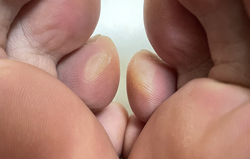 　今天走不多，只有四五公里吧，右腳的水泡比左腳還大，主要該是昨天那二十幾公里路的貢獻。